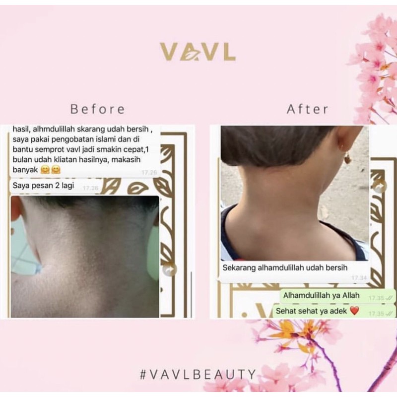VAVL BEAUTY WATER / VIGHTNE BLEMISH SERUM /FACIAL CLEANSER / SUNSCREEN / BODY SERUM / PEELING SPARY