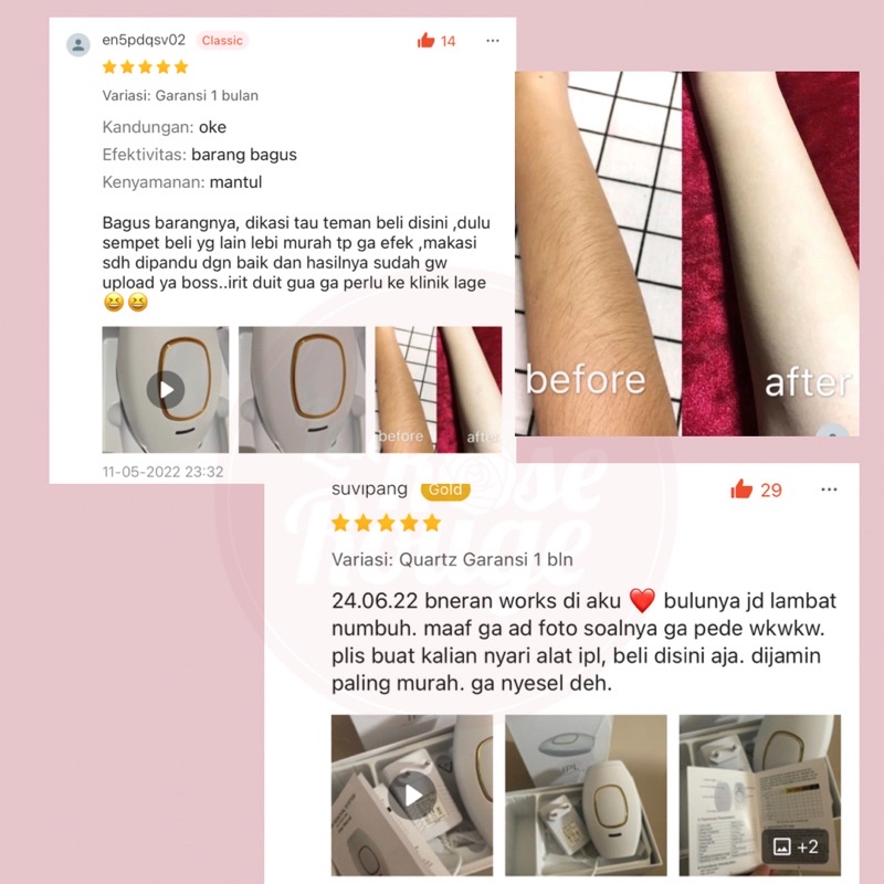 IPL ALAT PENGHILANG BULU PERMANEN / IPL HAIR REMOVAL TANPA SAKIT