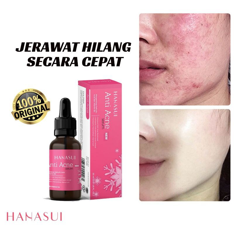 SERUM HANASUI ANTI ACNE PEMUTIH WAJAH PENGHILANG JERAWAT DAN BEKAS JERAWAT PENGHILANG FLEKHITAM BPOM
