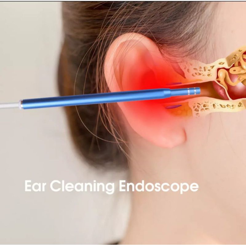 Pembersih Telinga Anak Dewasa Kamera Ear Cleaning Endoscope