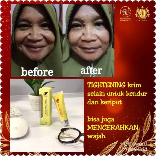 TIGHTENING CREAM SR12 / WHITENING TERBAIK / PENCERAH WAJAH / PENGENCANG ANTI KERUT WAJAH / HERBAL TIGHTENING CREAM SR12 / Krim hilangkan kerutan dalam 10 menit  Skin Tightening krim sr12