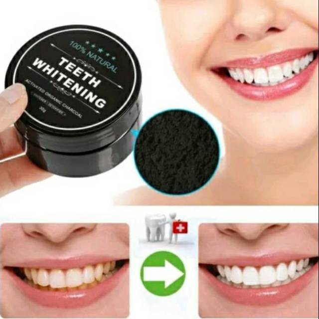 Teeth Whitening