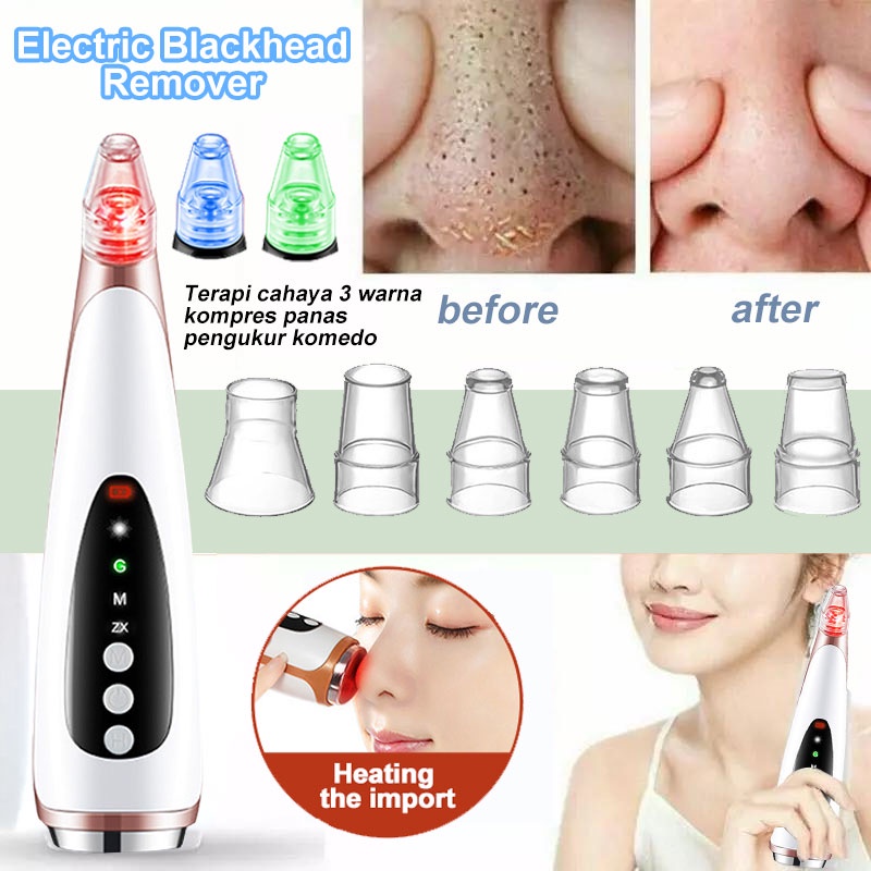 Alat Penyedot Komedo Facial Wajah Electric /Vakum Penyedot Komedo/Alat Pencabut Komedo/Blackhead pembersih tools