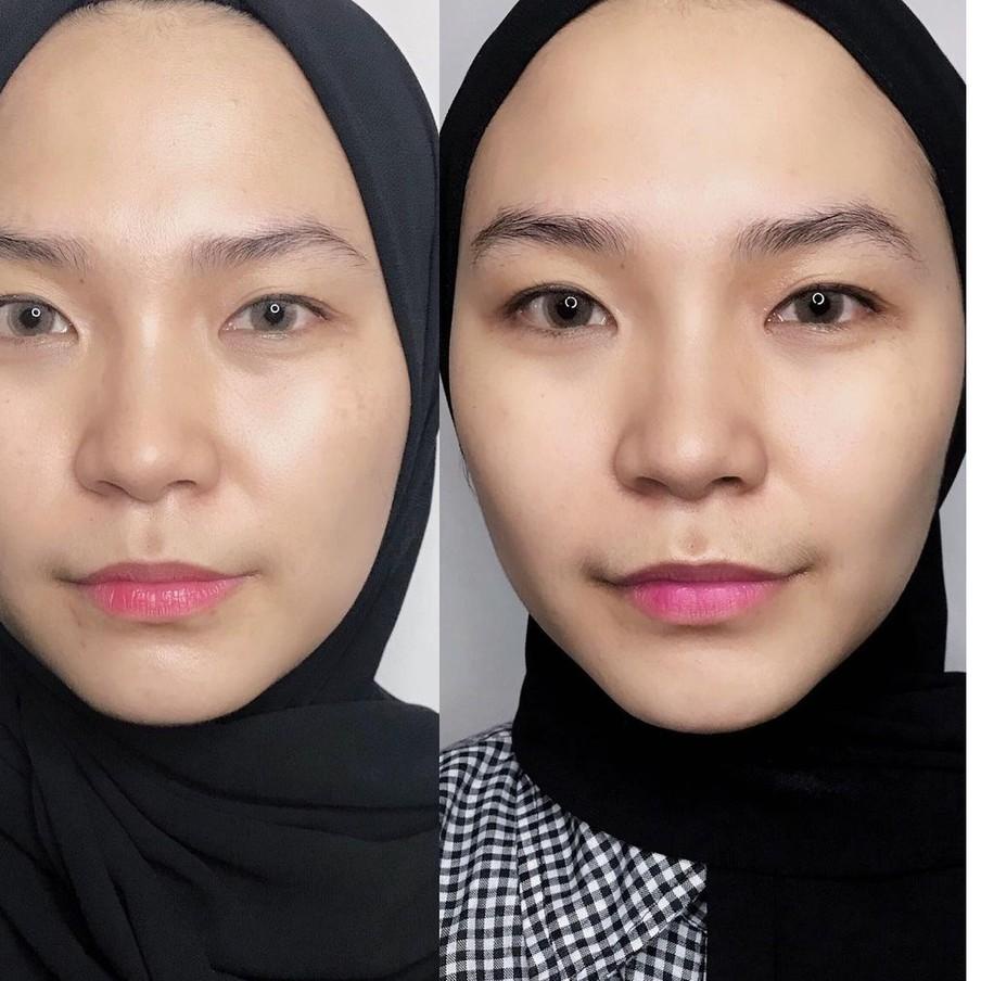 PROMOSI  9.9 Marine Therapy Dark Spot Correcting Serum | ALWAYS BE PURE [KODE 646]