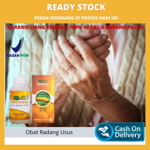 Obat Radang Sendi Akut, Obat Radang Sendi Tangan, Lutut Bengkak, Asam Urat, Sendi Bengkak, Obat Nyer