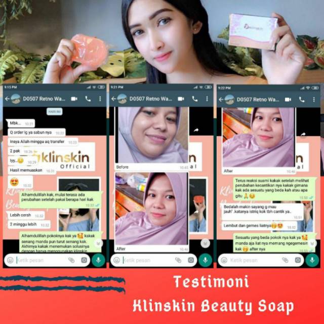 7pcs sabun klinskin beauty soap