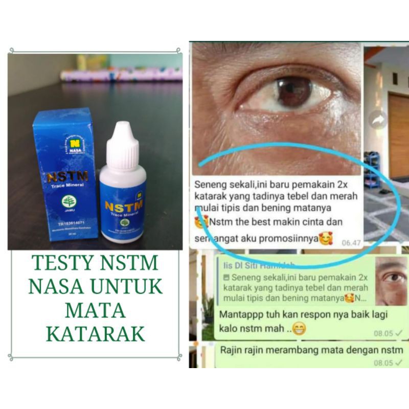 Obat NSTM Nasa untuk Mata Katarak