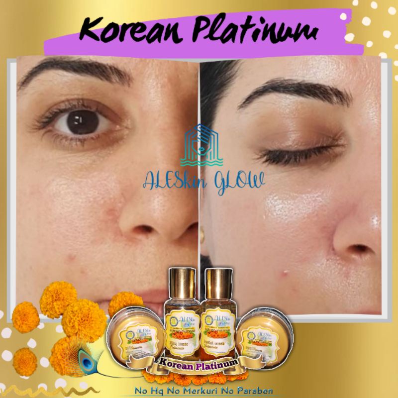 KOREAN PLATINUM ALESKIN GLOW Skincare Glowing-Paket Perawatan Wajah Korea-Cream Glowing