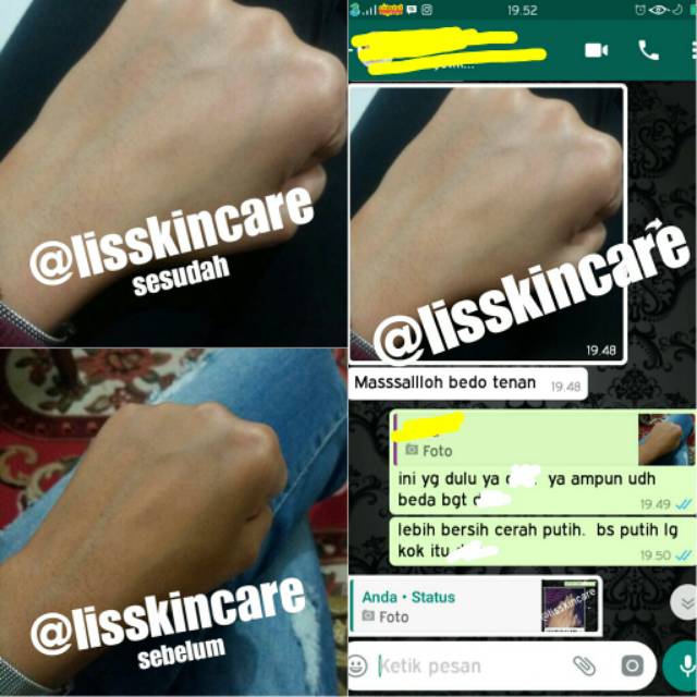 PROMO HB WHITENING BPOM DOSIS TINGGI ANTI STREATMARK / BACA DESKRIPSI / BERKUALITAS di jamin putih dan ori 100% dosis tinggi / Ampuh Putih