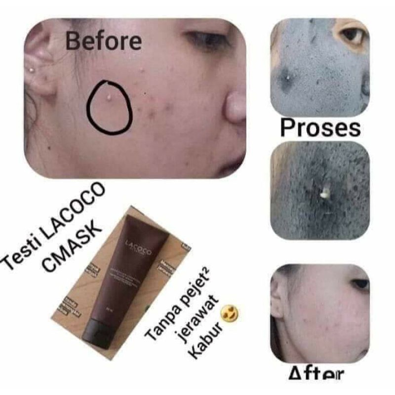 Masker Wajah Lacoco Amazonian Charcoal