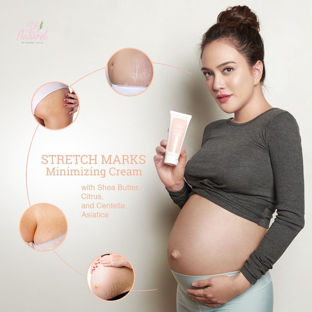 SA Stretch Marks Minimizing Cream by shandy aulia SA NATUREL / cream strecth mark [SA STRETCH]