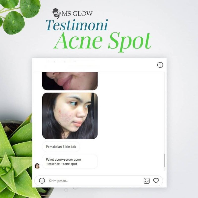 PROMO SPOT TREATMENT MSGLOW DARK SPOT PORE AWAY ACNE SPOT