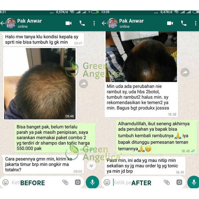 Perawatan Rambut Paling lengkap Green Angelica Paket Maximal Treatment