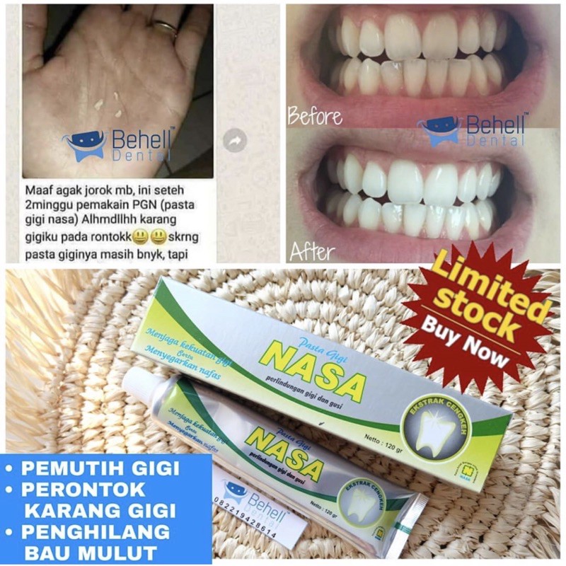 PGN Pasta Gigi Nasa . Odol Pemutih Gigi Nasa 100% Original . PENGHILANG KARANG GIGI / BAU MULUT