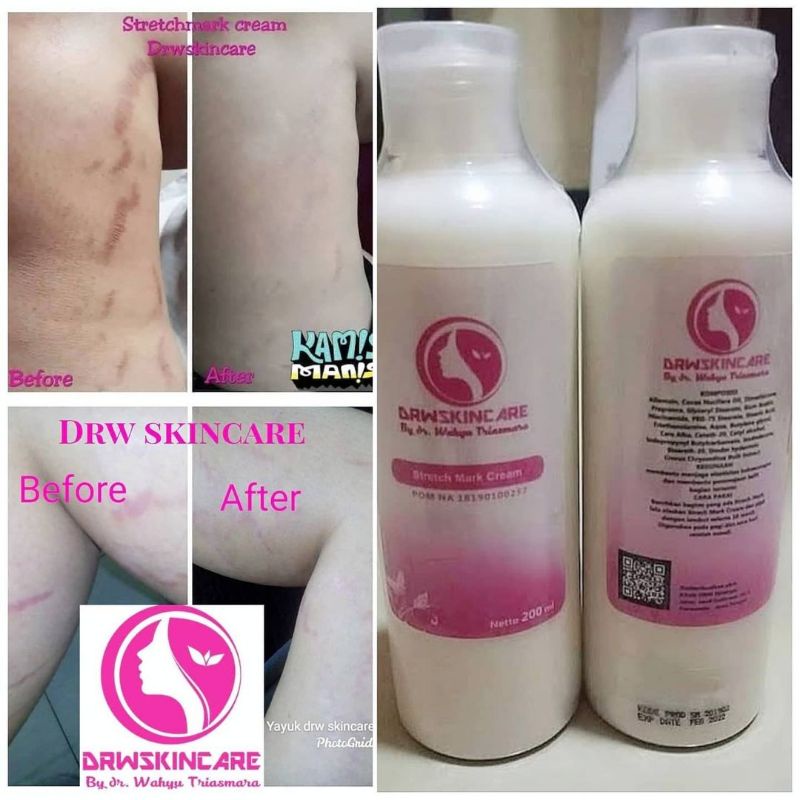 STRETCH MARK/Selulit CREAM DRWSKINCARE