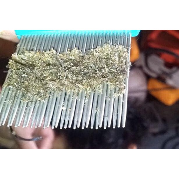 SISIR ANTI KUTU / SISIR SERIT STAINLESS SERBAGUNA TERMURAH !!