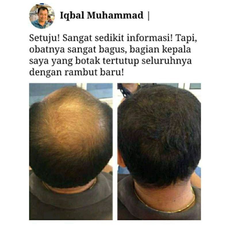 KERANITY ASLI 100% ASLI ORIGINAL OBAT PENUMBUH RAMBUT RUSAK RONTOK BOTAK MANJUR DIJAMIN KHASIATNYA