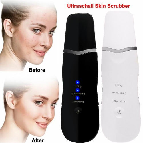 Alat Kecantikan Skin Scrubber Penghilang komedo Pembersih Wajah