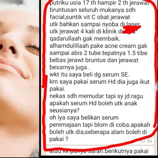 ❋ ELNINO'S ANTI-JERAWAT 125% PATEN RACIK BEAUTY CLINIC ♫