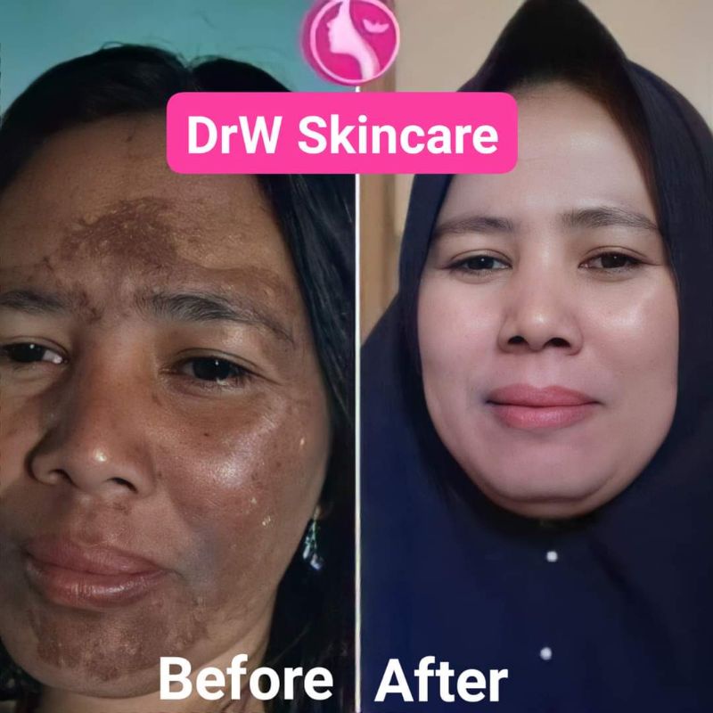 Paket Radiant Brightening  Drw skincare/Cream Flek/Cream Glowing