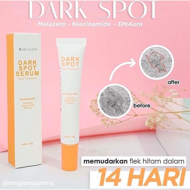 

dark spot