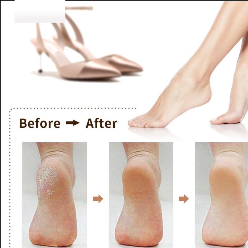 Penghalus Kaki Elektrik/Portable callus Remover/ Pedicure menicure Foot Grinder /Untuk Menghilangkan Kulit Mati Dan KapalanBarang spot