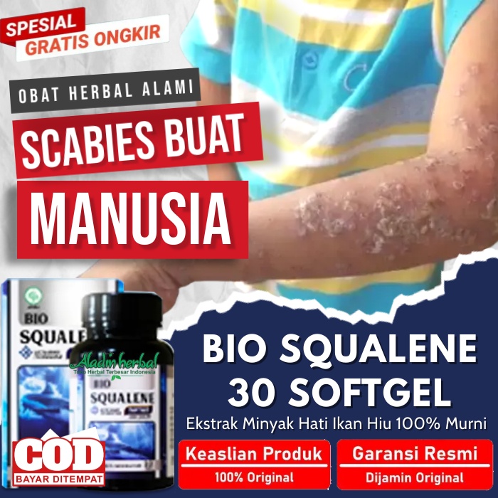 Jual Obat Scabies Manusia Terlaris Obat Gatal Scabies Obat Gatal Kulit Selangkangan Dan Hitam