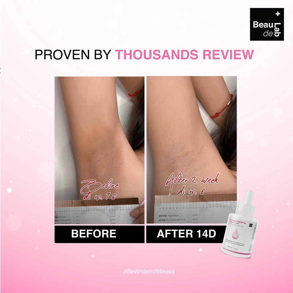 Beaudelab Underarm Brightening Serum AHA | Pemutih Ketiak Selangkangan Instan Cepat| Penghilang Bekas Luka-1