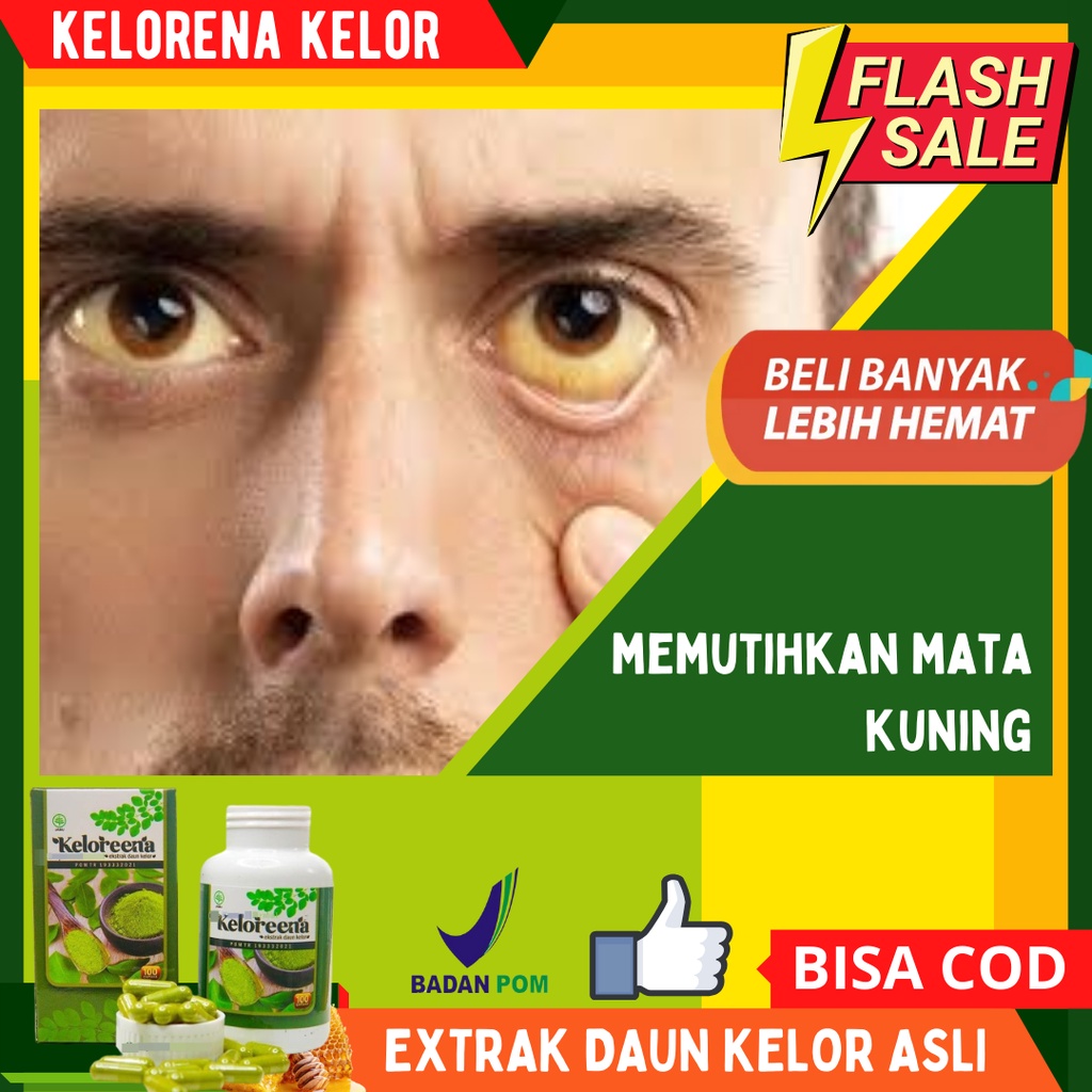 Kelorena Herbal Suplemen Mata - Memutihkan Mata Kuning agar kembali putih, Membersihkan Mata Kotor, 