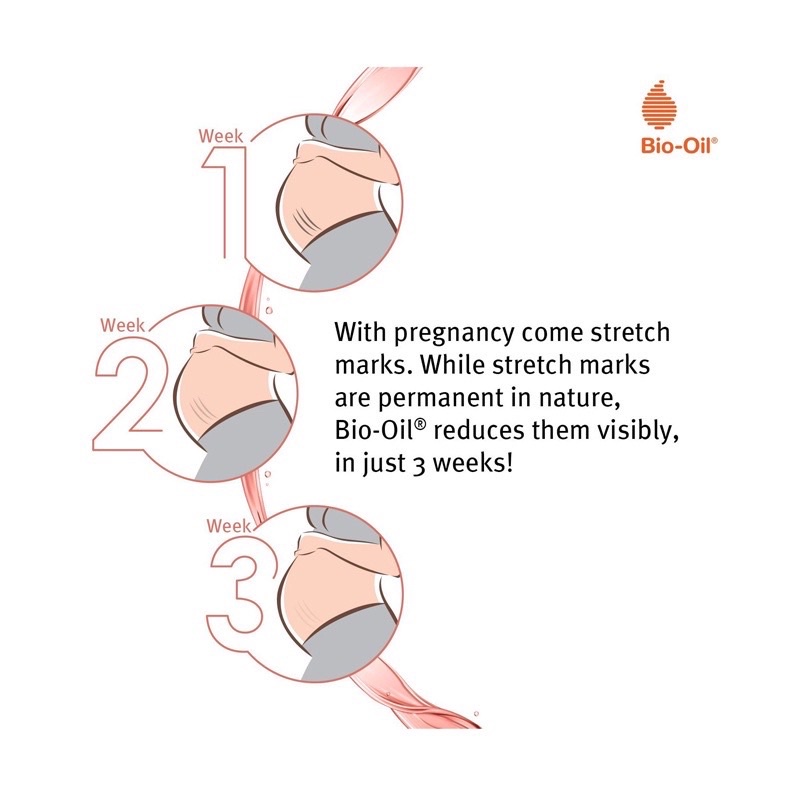 BIO OIL Skincare Minyak Perawatan Kulit/Minyak penghilang bekas lusa/penghilang stretch marks