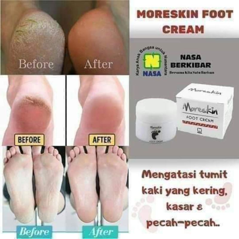 

footcream