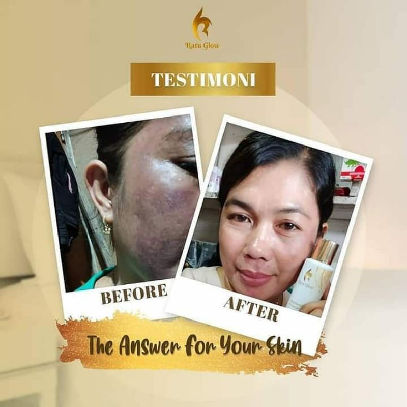 RATU GLOW REGULER/RATU GLOW PLATINUM/REGULER ACNE BRIGHTENING/PLATINUM ACNE BRIGHTENING-5