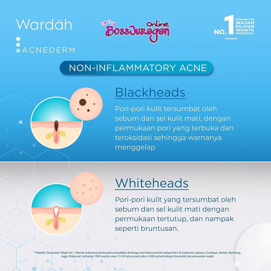 (BOSS) WARDAH Acnederm Series | WARDAH ACNEDERM Mengatasi Jerawat Dan Bekas Jerawat - WARDAH ACNE DERM