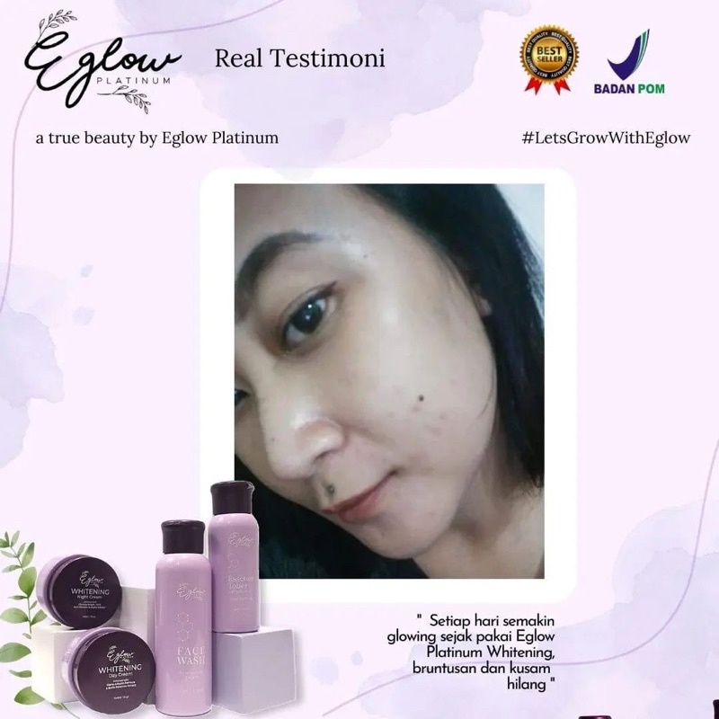 EGLOW PLATINUM PEMUTIH WAJAH PENGHILANG JERAWAT PENGHILANG FLEK KUSAM EGLOW ORIGINAL EGLOW BPOM PAKET WHITENING ACNE ULTIMATE