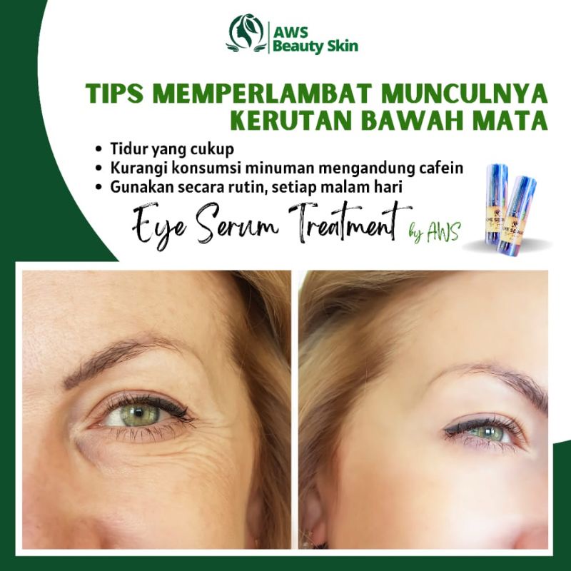 SERUM EYE SERUM PRODUK DARI AWS BEAUTY SKIN