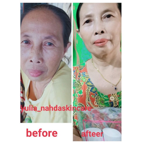 BAYAR DITEMPAT || NAHDA SKINCARE ORIGINAL 100% ORIGINAL || FREE BONUS MENARIK !!-5