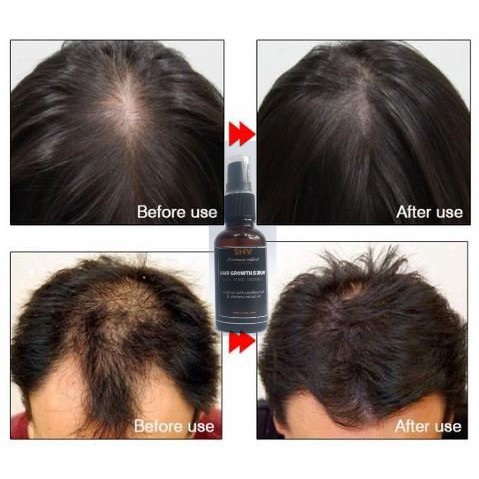 SERUM PENUMBUH RAMBUT ALAMI HAIR GROWTH SERUM SHEVANNA