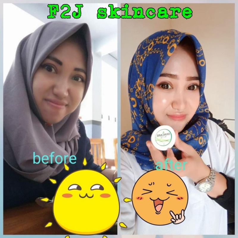 [Free Gift] SKINCARE F2J/EXLUSIVE/PLATINUM/ACNE-4