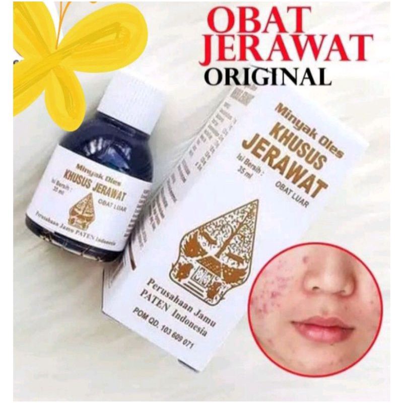 ORIGINAL OBAT JERAWAT MINYAK OLES KHUSUS JERAWAT CAP WAYANG