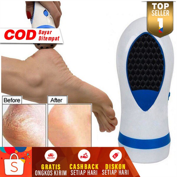 Alat Pembersih Telapak Kaki Penghilang Kapal Kulit Mati Pada Tumit Pedicure Pedi Spin PediSpin