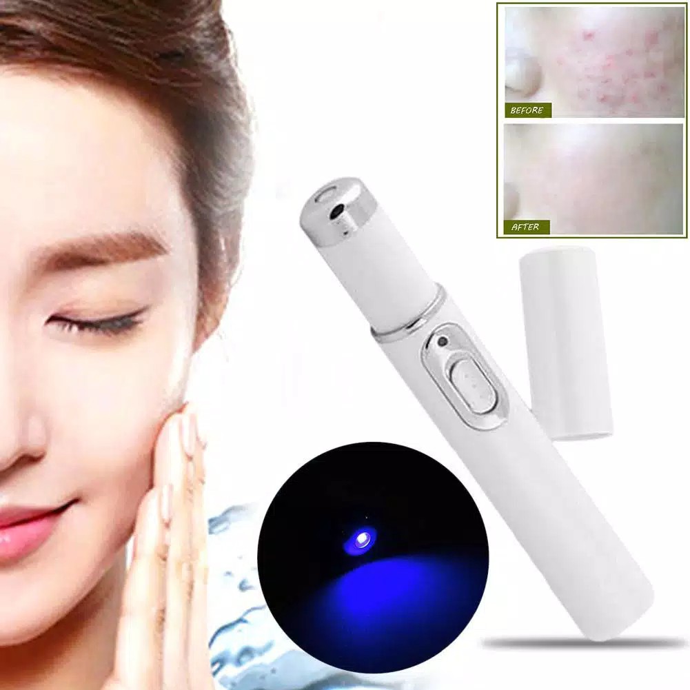 LASER WAJAH / MENGHILANGKAN NODA DI WAJAH