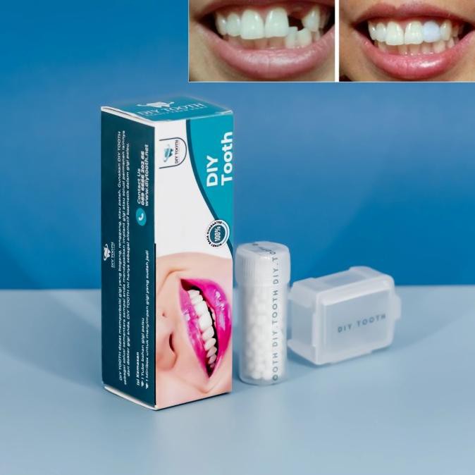 DIY TOOTH gigi palsu sementara / lem gigi palsu / temptooth