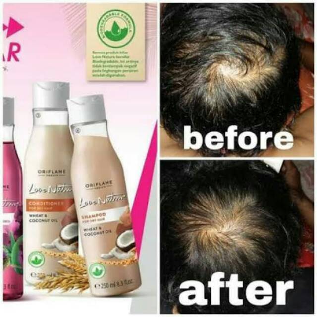 Shampo Untuk Rambut Berkutu