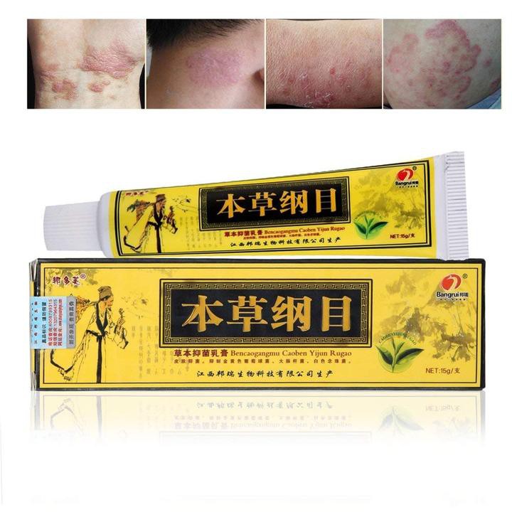 Cream Eksim Kulit Gatal  Psoriasis Jerawat Ruam Jamur Kudis Kurap Kutu Air Obat Kulit Gatal Anti bakteri Anti Gatal Krim Kulit Psoriasis Dermatitis Eksim (SALEP KUNING) 15g