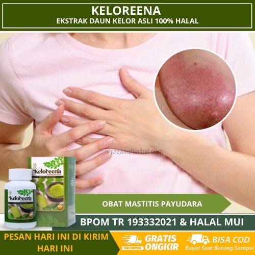 Keloreena - Obat Mastitis Payudara, Radang Payudara, Infeksi Payudara, Payudara Bengkak & Nyeri, Pay