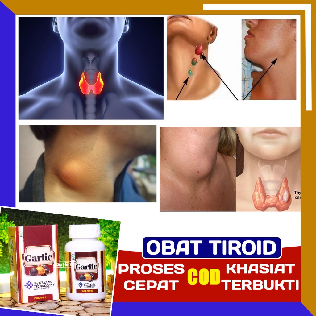 Obat Benjolan Di Leher Sebelah Kanan Kiri Depan Belakang Tiroid Kelenjar Black Garlic Kapsul Shopee Indonesia