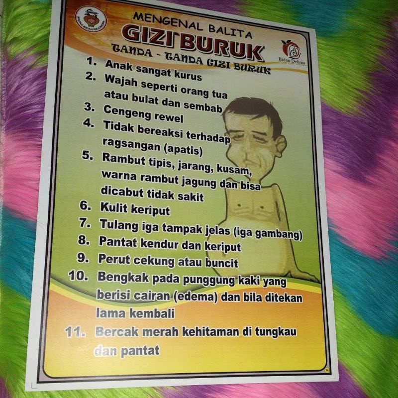 

Poster Mengenal Balita Gizi Buruk