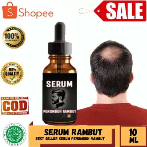 SERUM PENUMBUH RAMBUT-MINYAK PENUMBUH - Penumbuh Rambut Secara Cepat / Obat Penumbuh Rambut Botak Su