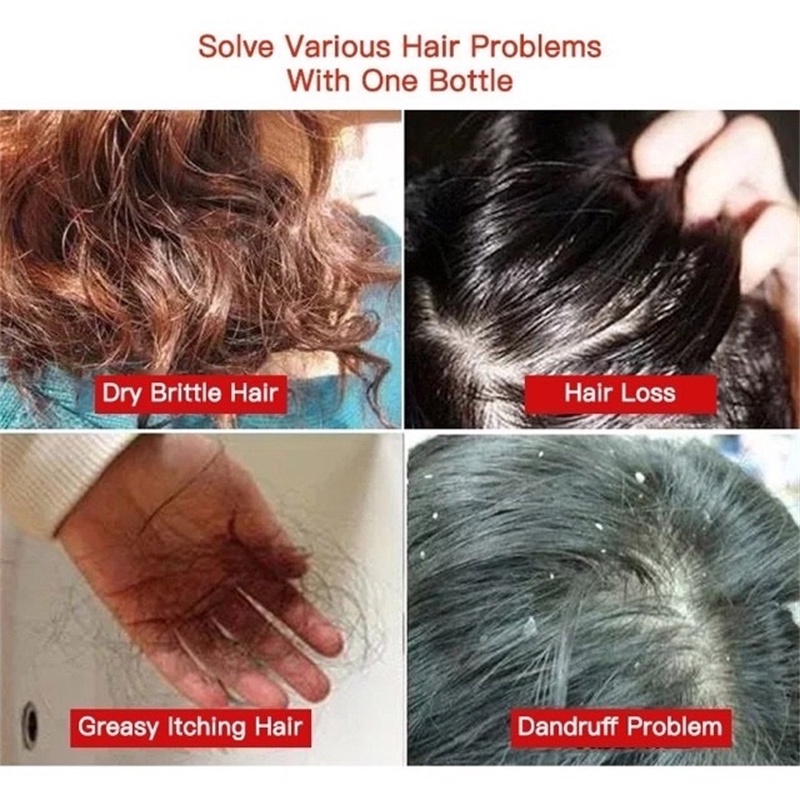 Sampo anti ketombe Mencegah rambut rontok Mencegah ketombe Sampo garam laut Shampo anti tungau Shampo Aroma 400ml Mencegah rambut berminyak Antiketombe, antipruritic oil control asam amino panjang