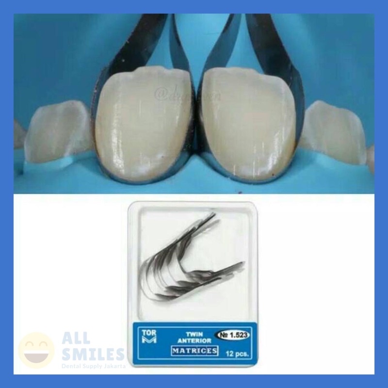Dental twin anterior matrix TOR original ori matriks proximal gigi depan veneer